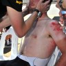 CAVENDISH-INJURY1-96x96.jpg
